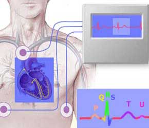 Example of a wearable Holter monitor with chest electrodes